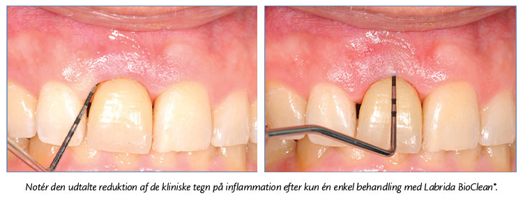 Den kliniske situation efter 4 uger